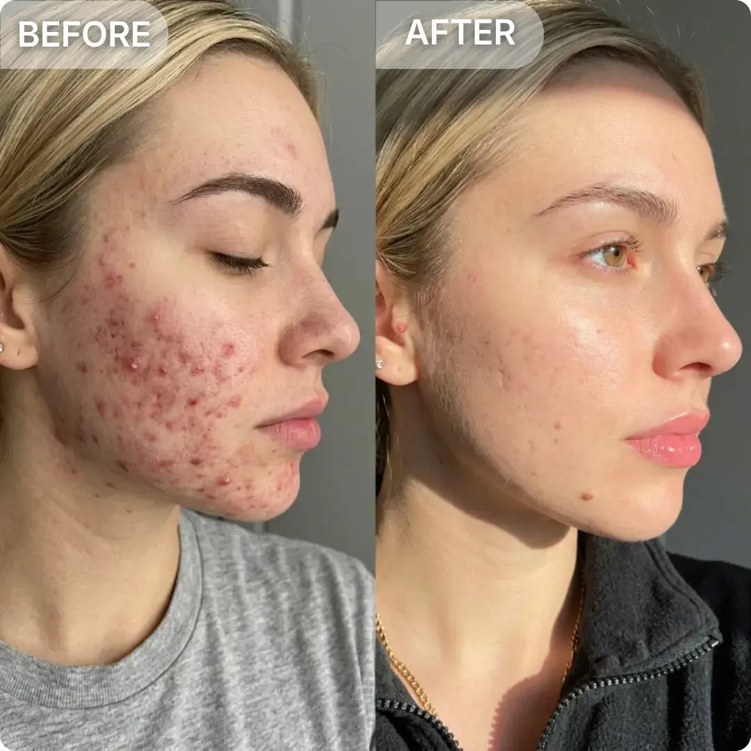 Skin result comparison