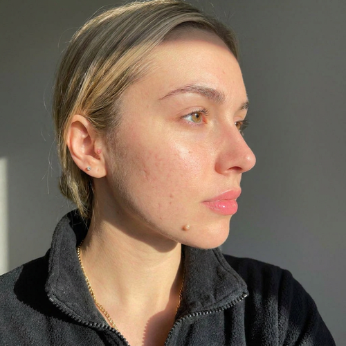 Breakouts & Scaring — after