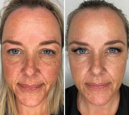 Customer skincare result